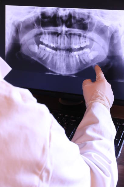 Best Emergency Dental Extractions in Troutdale, OR